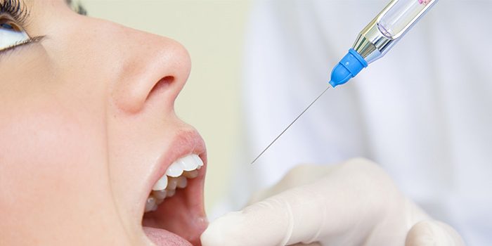 protesi ai denti